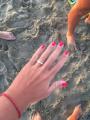SOS Perso anello - Camaiore (LU)