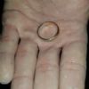 SOS Perso anello - Rosolina (RO)