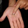 SOS Perso anello - Pulsano (TA)
