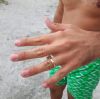 SOS Perso anello - Sesto Calende (VA)