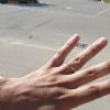 SOS Perso anello - Lignano Sabbiadoro (UD)